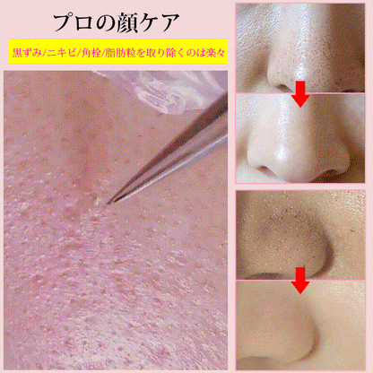 ステンレススチールコメドプッシャー