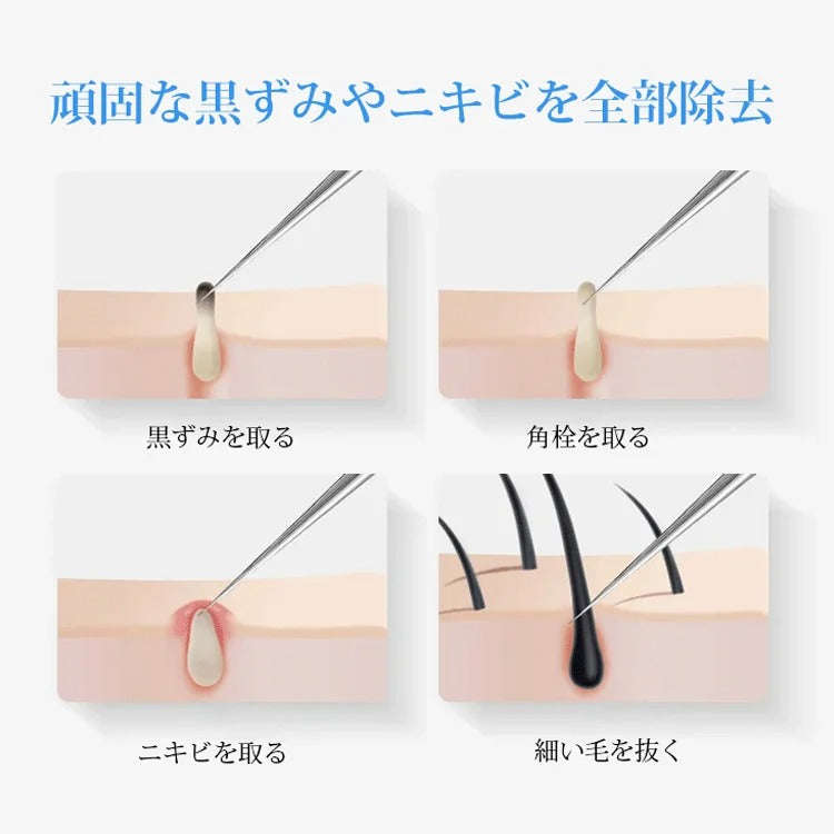 ステンレススチールコメドプッシャー